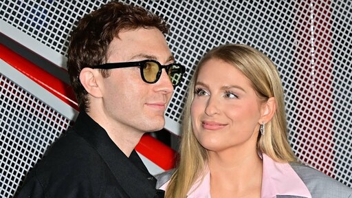 Meghan Trainor kan niet meer glimlachen door te veel botox