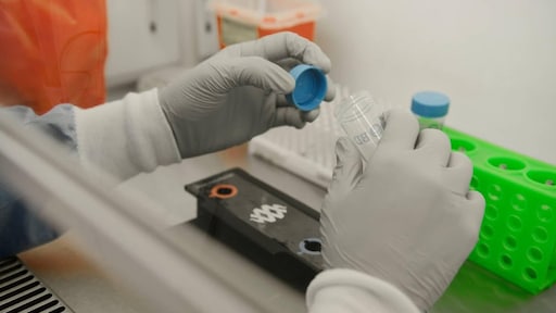 Tien coronabesmettingen bij tests Bundesligaclubs