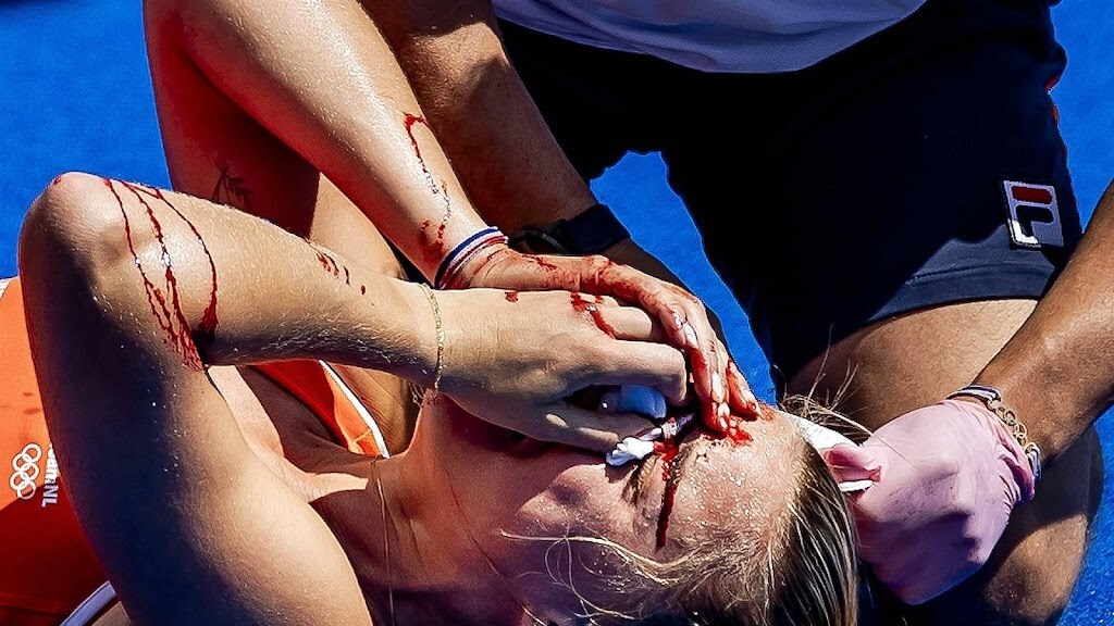 Hockeyster Burg wilde finale spelen maar Van Ass voorkwam dat