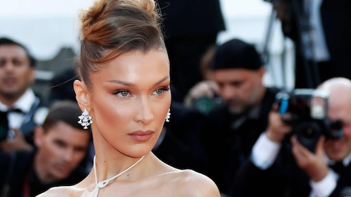 Cosmetisch chirurg: gezicht Bella Hadid komt dichtbij perfectie