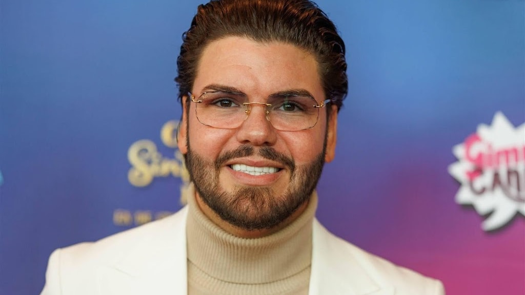 Roy Donders krijgt waarschuwing na spuiten fillers