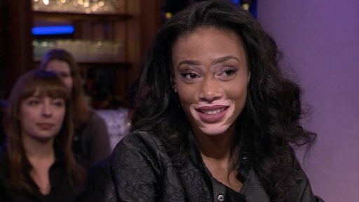 Winnie Harlow: Ik wil op de cover van Vogue