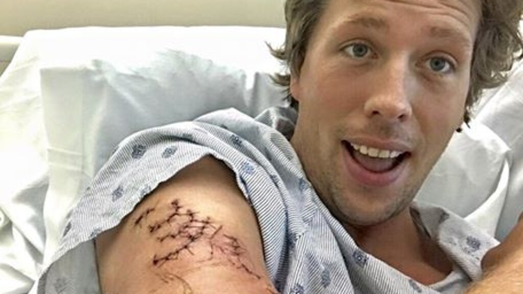 Door haai gebeten Freek Vonk: 'Nog steeds geen gevoel in mijn onderarm'