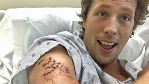 Door haai gebeten Freek Vonk: 'Nog steeds geen gevoel in mijn onderarm'