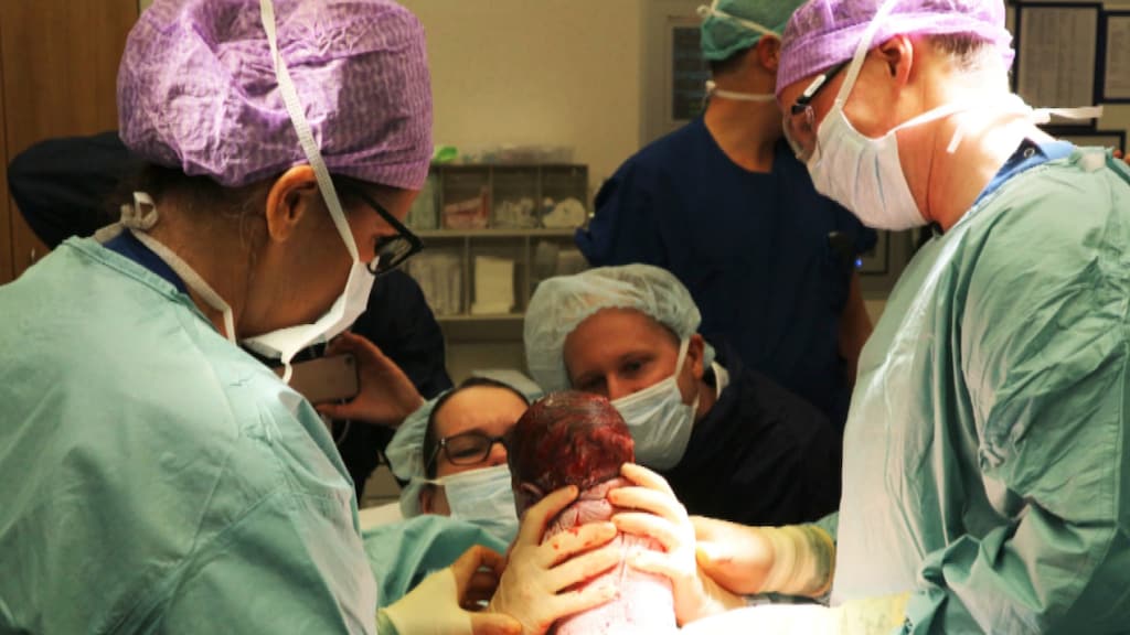 Primeur in Nederland: moeder tilt zelf dochtertje uit haar buik tijdens keizersnede