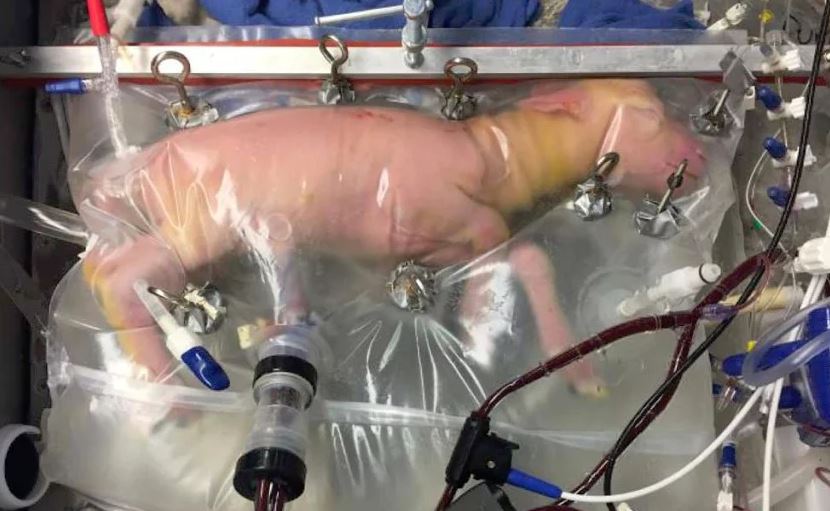 Kunstmatige baarmoeder moet premature baby's meer kans geven