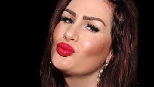 Louisa Janssen: 'Ik doe cosmetische ingrepen uit onzekerheid'