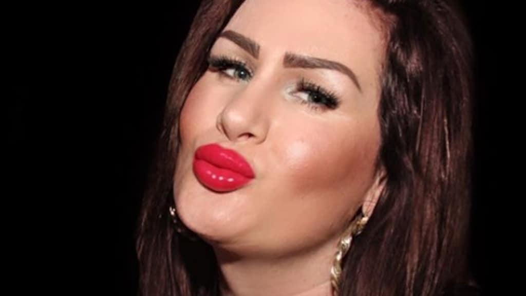 Louisa Janssen: 'Ik doe cosmetische ingrepen uit onzekerheid'