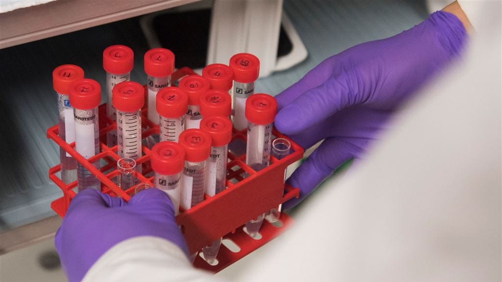 Jaarlijks 100 onnodige sterfgevallen door baarmoederhalskanker