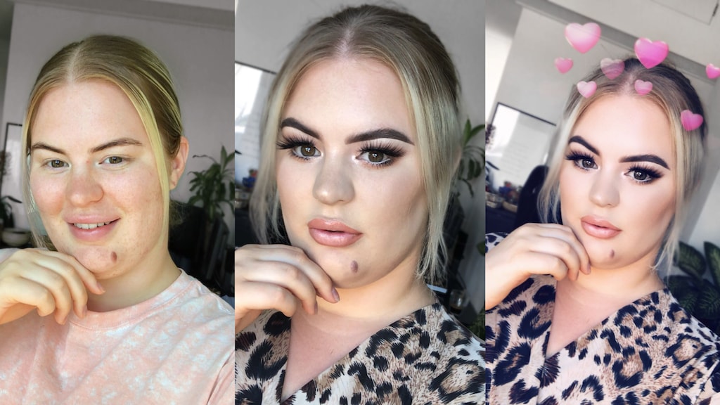 Permanente Snapchat-filter door chirurg: 'Ze willen echt op hun filter lijken'