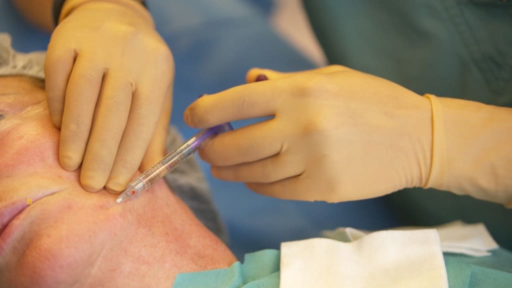 Alarm over risico’s van 'mooimakende' fillers