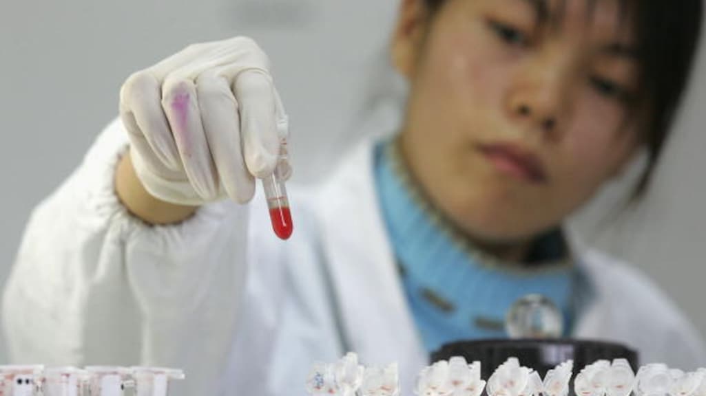 Genezing van hiv is een stap dichterbij, maar we zijn er nog niet