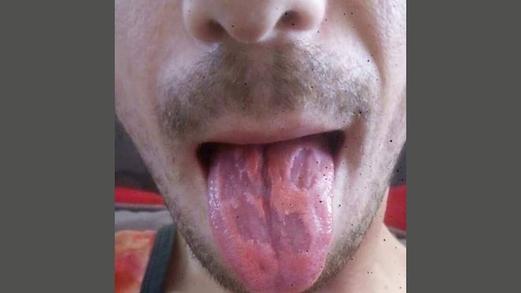 Wat is dat voor een vieze lap vlees? Een tong na te veel energiedrank