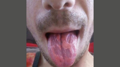 Wat is dat voor een vieze lap vlees? Een tong na te veel energiedrank