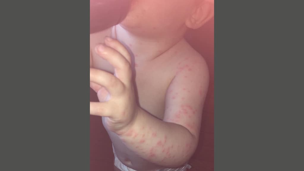 Ook baby Jady zit onder de vlekken.