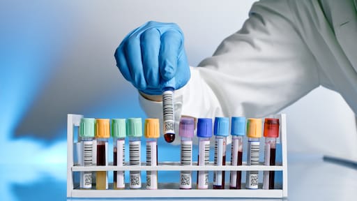 Immuunziekten behandelen op basis van moleculaire handtekening