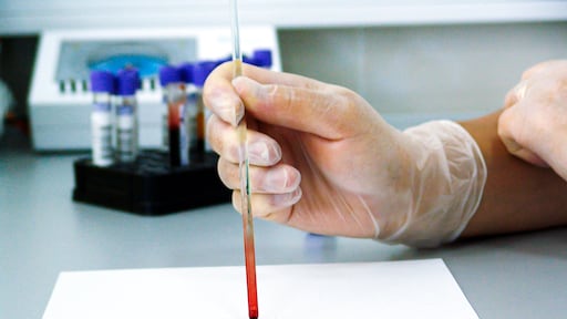 Dít is waarom je een uitstrijkje moet laten maken