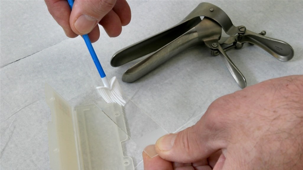 Die middeleeuwse eendenbek bij een uitstrijkje: moet dat nou?