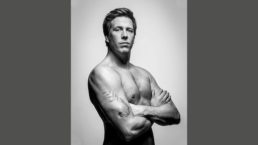 Freek Vonk toont litteken na haaienbeet: 'Gevoel in huid is nooit teruggekomen'