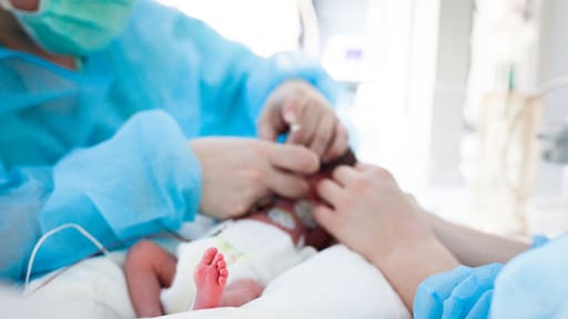 'Snijwonden bij meer baby's door keizersnee'