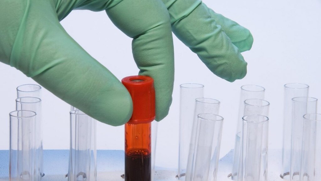 Nederlands onderzoek naar de relatie tussen corona en trombose