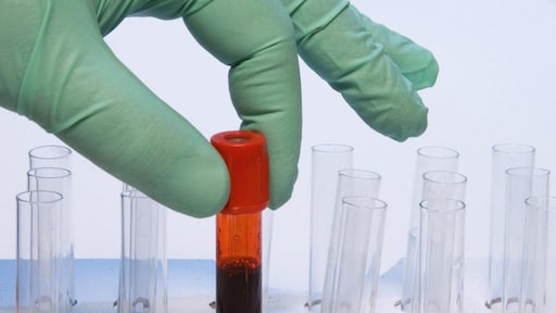 Nederlands onderzoek naar de relatie tussen corona en trombose