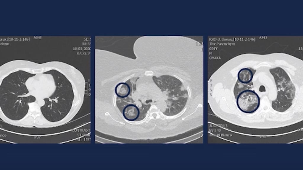 De arts toonde deze drie scans.