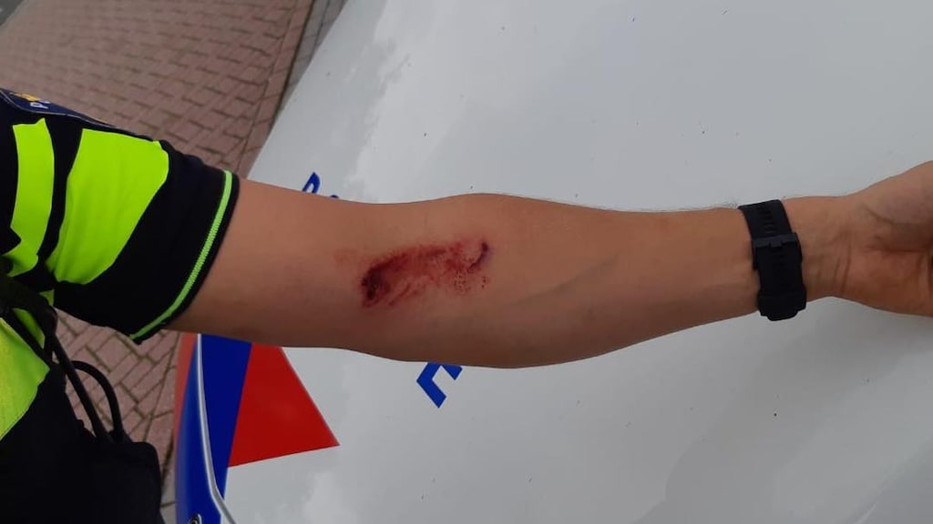 Agent loopt flinke bijtwond op bij arrestatie