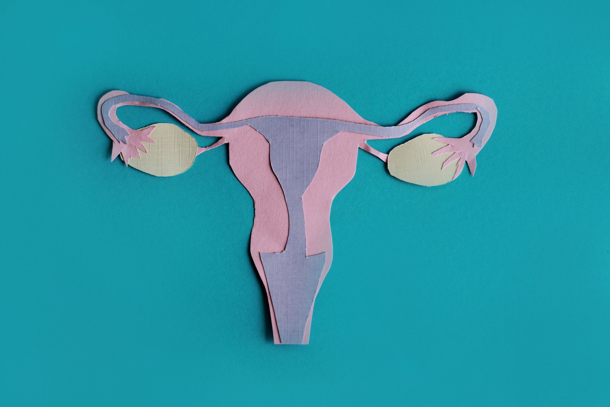 De behandeling van PCOS: 'Zwangerschap is niet het énige doel'