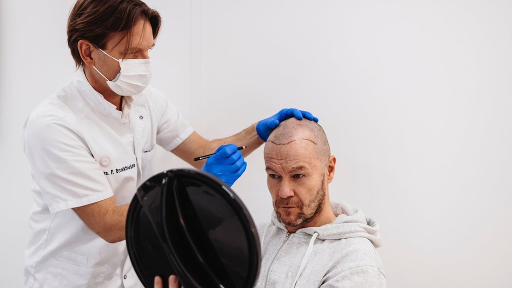 Gijs Staverman eerlijk over haartransplantatie: 'Maakte me onzeker'