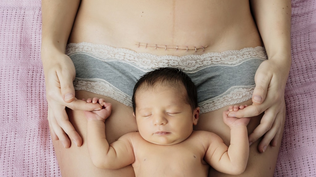 Baas over eigen baren: 'Vaginaal bevallen lijkt me veel te rommelig'