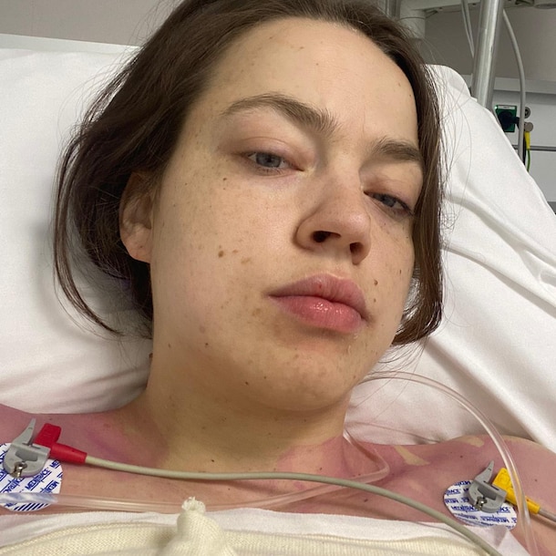 Tara, vlak na haar operatie