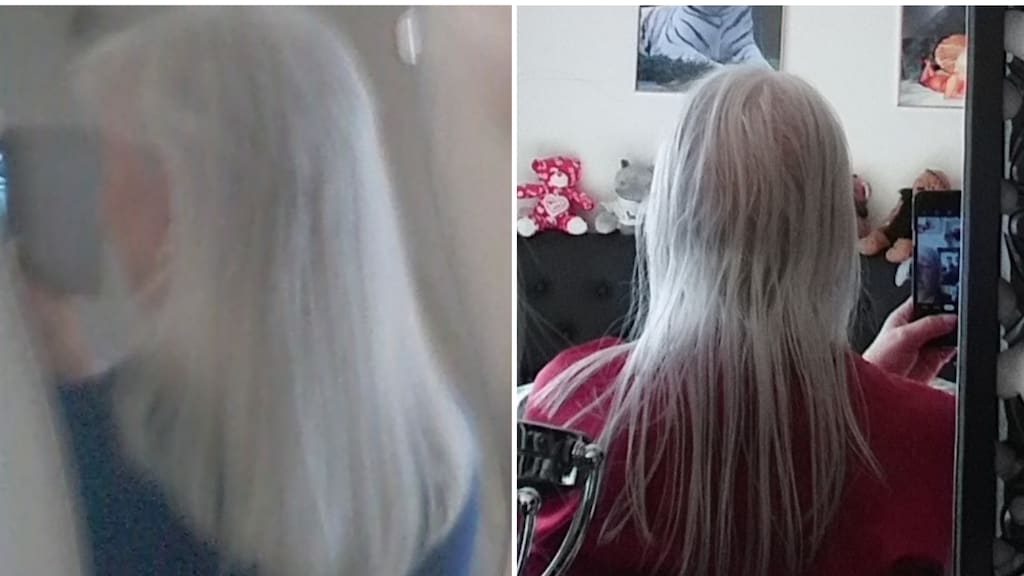 Lievens voor de haaruitval (l) en Lievens toen de eerste kale plekken zichtbaar werden (r).