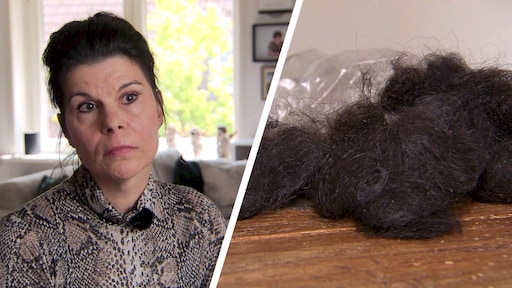 Extreme haaruitval na corona: 'Ik trok bossen tegelijk uit mijn hoofd'