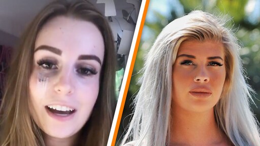 Lesley uit EOTB heeft wond in gezicht na voedselgevecht met Shani