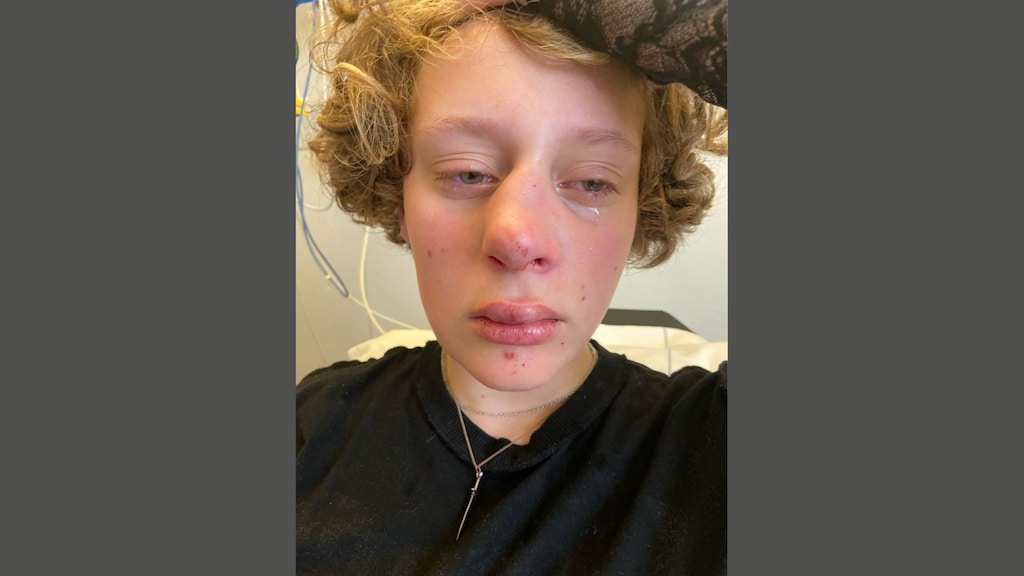 Politie houdt 14-jarige verdachte aan voor zware mishandeling Frédérique