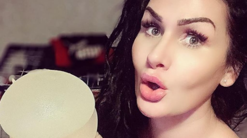 Louisa Janssen dolblij na ingrepen in Turkije: '7 liter vet weg'