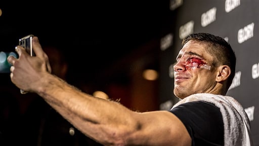 Gezichtsherkenning toegetakelde Rico Verhoeven werkt niet meer na spectaculair gevecht