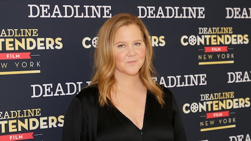 Amy Schumer wil graag eerlijk zijn over liposuctie