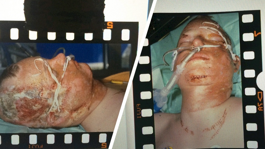 Sebastiaan was verlamd vanaf zijn nek.