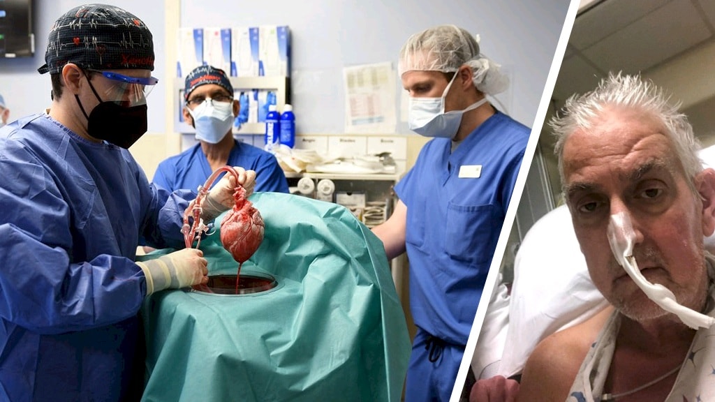 Man die varkenshart kreeg, overleed aan varkensvirus: 'Leerzame ervaring'