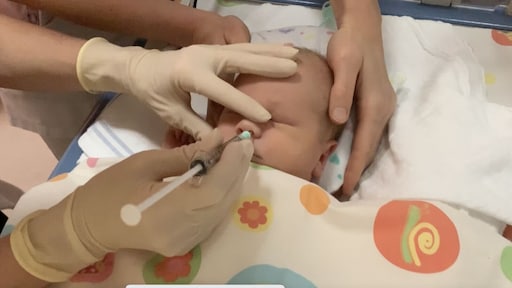 Baby met hersenbeschadiging na infarct heeft baat bij speciale neusdruppels