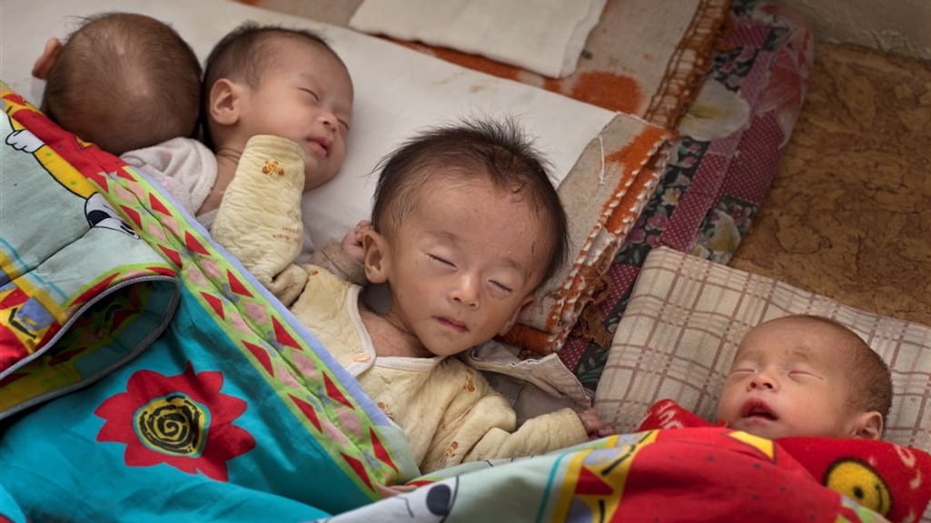 Een archieffoto die ondervoeding bij kindjes in Noord-Korea laat zien.