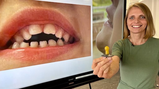 Deskundigen waarschuwen: pas op met ronde speen