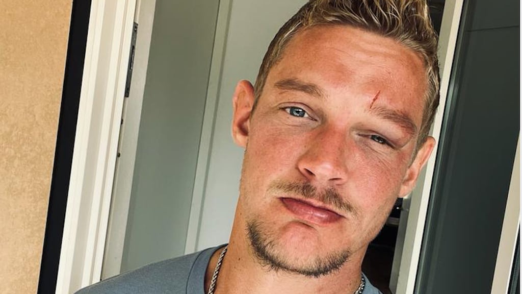 Ferry Doedens loopt hoofdwond op na val van trap