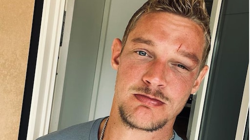 Ferry Doedens loopt hoofdwond op na val van trap