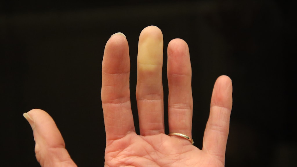 Janneke: 'Mijn vinger slaat soms wit uit'