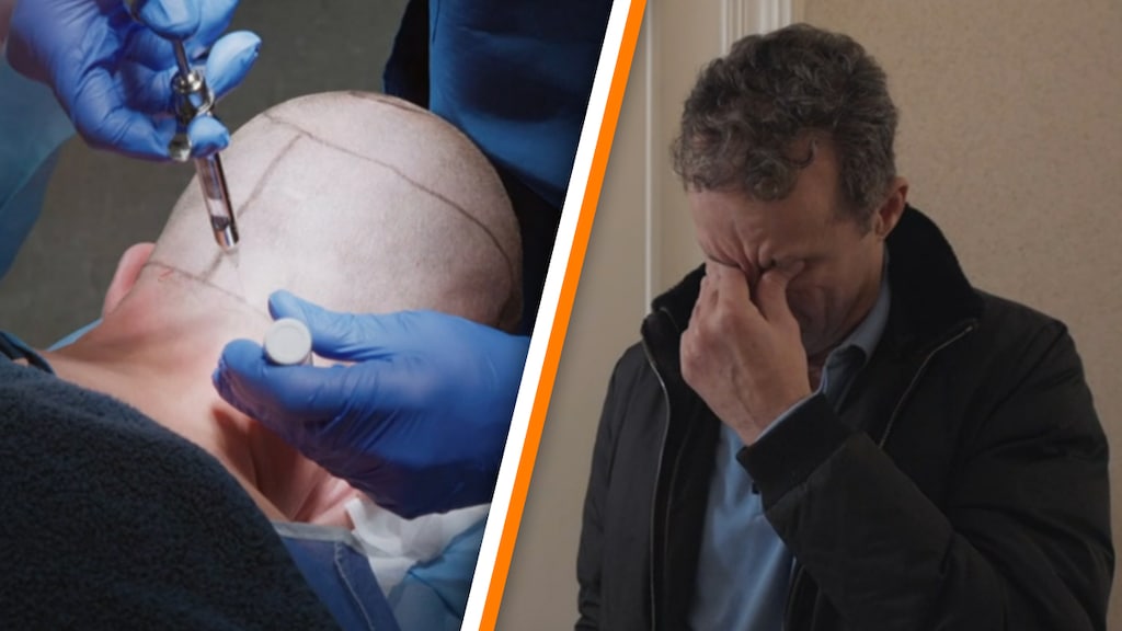John in tranen om haartransplantatie Kees in De Bevers: 'Verschrikkelijk'