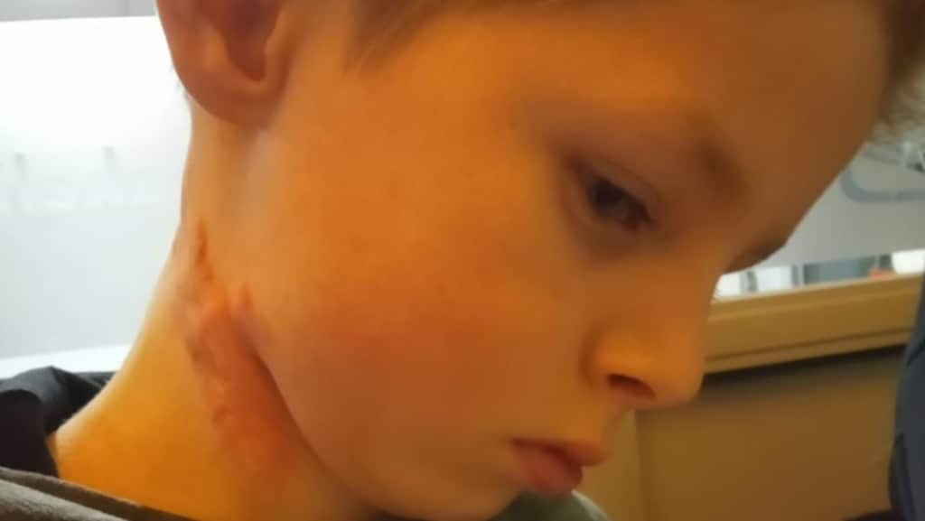 Zo ziet Diony's nek er nu uit.