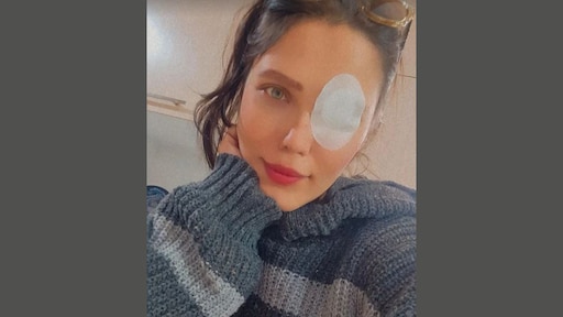 Iraanse vrouwen verminkt: troepen schieten bewust op ogen